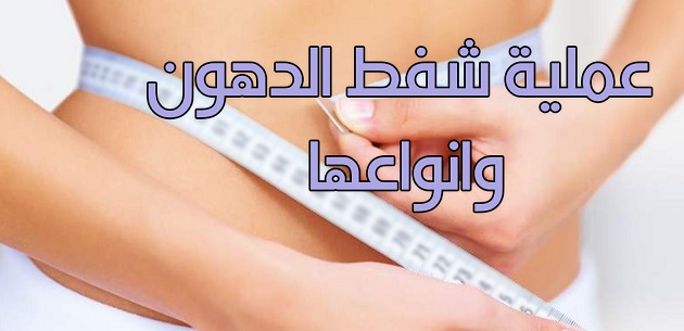 تعرف عملية الدهون وانواعها 361423997.jpg